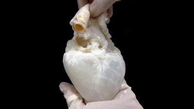 A ‘ghost heart’ is a pig’s heart prepared so that it can be transplanted into people.