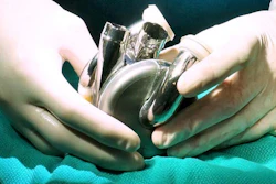Bi Vacor Total Artificial Heart Surgery