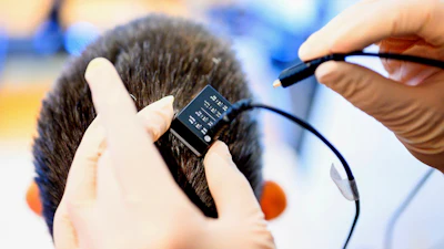 In this photo provided by researchers researchers at UCSF and UC Berkeley, a UCSF clinical research coordinator connects a neural data port into the head of Ann, a participant in a study on speech neuroprostheses, in El Cerrito, Calif., on Monday, May 22, 2023.