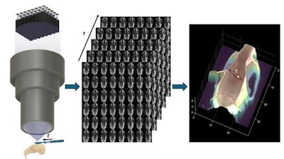 FiLM-Scope simultaneously captures 48 multiperspective images of a surgical scene. Using a custom reconstruction algorithm, these images can be converted into a dense 3D model.