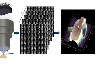 FiLM-Scope simultaneously captures 48 multiperspective images of a surgical scene. Using a custom reconstruction algorithm, these images can be converted into a dense 3D model.