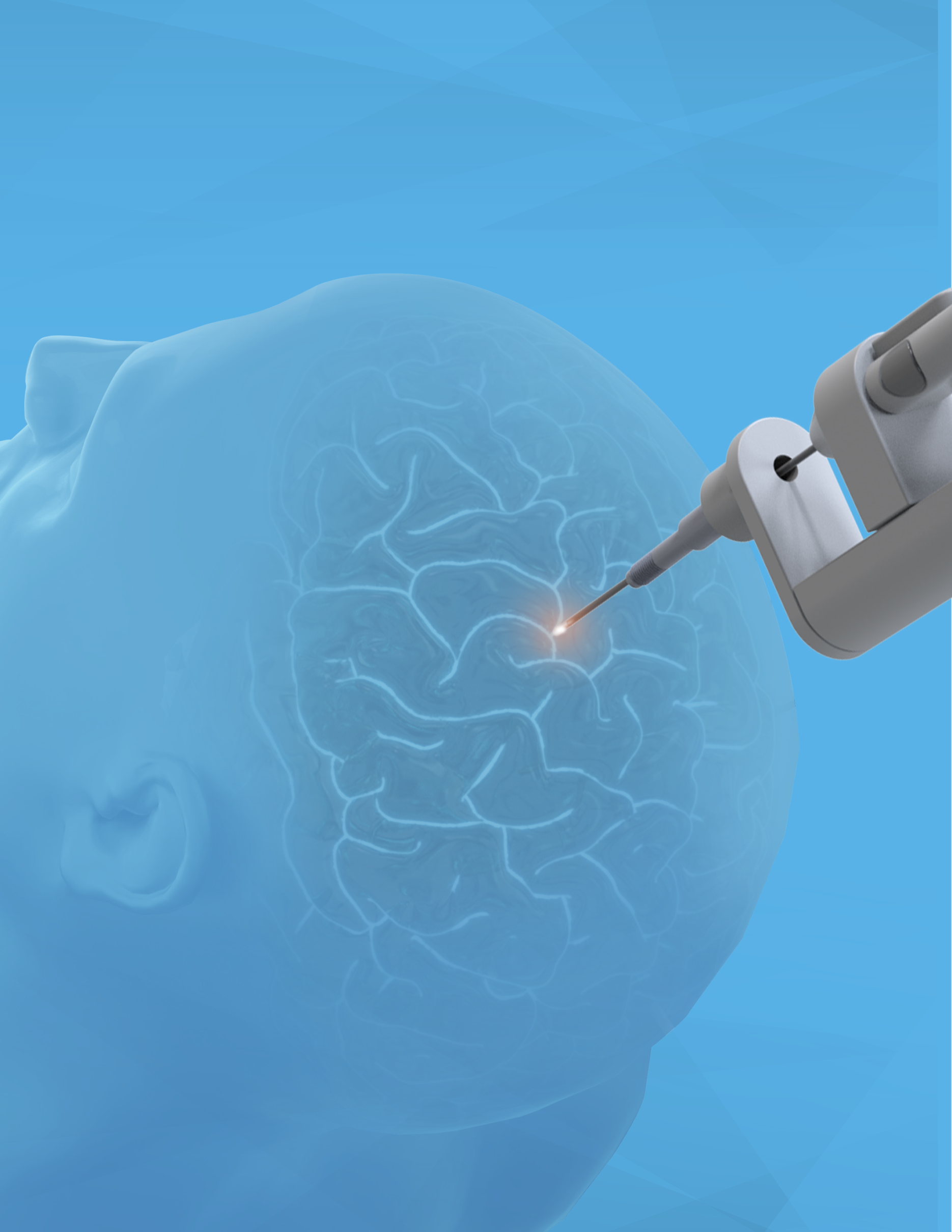 Monteris Medical and Symphony Robotics have partnered to evolve surgical precision with the use of advanced robotics for brain ablation surgery.
