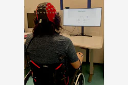 Signals from an EEG monitoring device could be used to send brain signals to a spinal cord stimulator, helping paralyzed patients control their limbs more effectively.