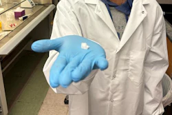 Texas A&M University biomedical engineering doctoral student and researcher Saptarshi Biswas holds a sample of the hemostatic dressing.