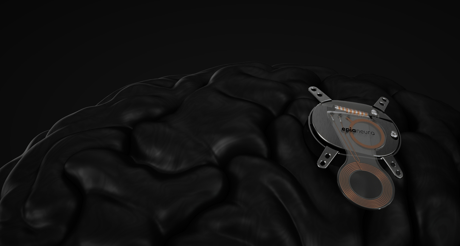 Epia Neuro Device