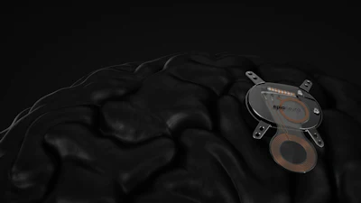 Epia Neuro Device