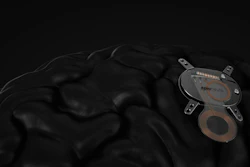Epia Neuro Device