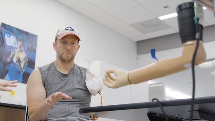 U.S. Man to Get First Bionic Arm Connected Directly to the Bone, Nerves and Muscles