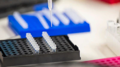 Pipette dispensing liquid into black microplate wells during laboratory sample preparation